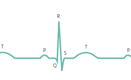 Normaal ECG met de P-top, QRS-complex en T-top