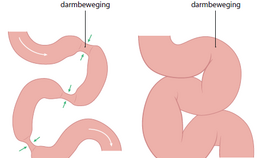 Gezonde darm en ileus (darmafsluiting)